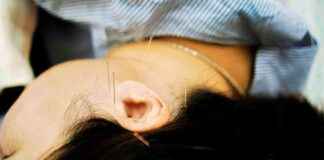 Acupuncturist Suspended for Leaving Needles in Patient’s Head and Toe acupuncturist-suspended-for-leaving-needles-in-patients-head-and-toe