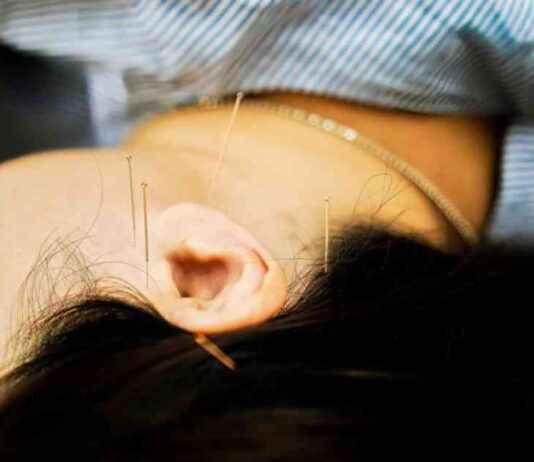 Acupuncturist Suspended for Leaving Needles in Patient’s Head and Toe acupuncturist-suspended-for-leaving-needles-in-patients-head-and-toe