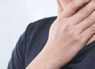 Understanding Tonsil Stones: Causes, Symptoms, and Treatment Options understanding-tonsil-stones-causes-symptoms-and-treatment-options