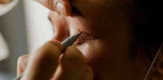 Unlicensed Beautician Jailed for Causing Drooping Eyelid: Legal Consequences Explained unlicensed-beautician-jailed-for-causing-drooping-eyelid-legal-consequences-explained
