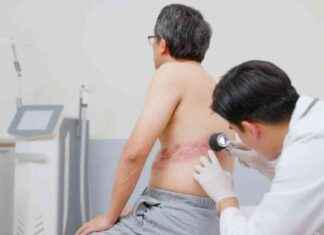 Extended Subsidies and MediSave for Shingrix Vaccine extended-subsidies-and-medisave-for-shingrix-vaccine